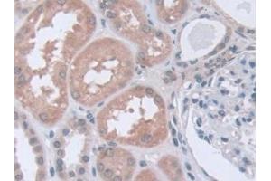 Detection of STIP1 in Human Kidney Tissue using Polyclonal Antibody to Stress Induced Phosphoprotein 1 (STIP1)