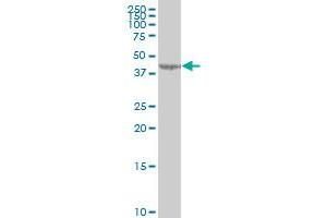 LYPLA3 monoclonal antibody (M01), clone 3B11 Western Blot analysis of LYPLA3 expression in HeLa .