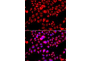 Immunofluorescence analysis of A549 cell using ETFA antibody. (ETFA anticorps)