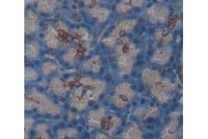 IHC-P analysis of Human Tissue, with DAB staining. (SEMA4B anticorps  (AA 644-832))