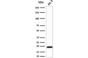 Western Blot Analysis of PC-3 cell lysate using NME2 / nm23-H2 Mouse Monoclonal Antibody (CPTC-NME2-2). (NME2 anticorps)