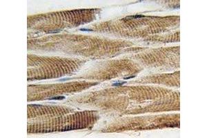 IHC analysis of FFPE human skeletal muscle tissue stained with DCX antibody