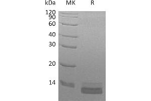 Chemokine (C-C Motif) Ligand 14 (CCL14) protein (His tag)