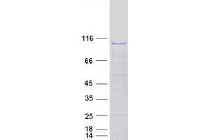 Validation with Western Blot
