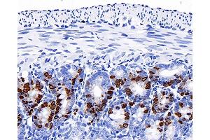 Immunohistochemistry analysis of paraffin-embedded mouse jejunum(intraperitoneal injection BrdU every 2 hours for 4 times) using Brdu Monoclonal Antibody at dilution of 1:300.