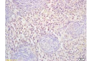 Formalin-fixed and paraffin embedded mouse embryo labeled with Rabbit Anti FLT3L Polyclonal Antibody, Unconjugated (ABIN1714763) at 1:200 followed by conjugation to the secondary antibody and DAB staining