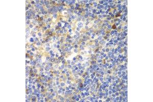 Immunohistochemistry of paraffin-embedded human amygdalitis using ZAP70 antibody.