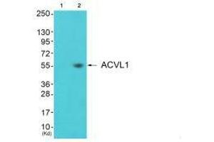 Western blot analysis of extracts from 3T3 cells (Lane 2), using ACVL1 antiobdy. (ACVRL1 anticorps)