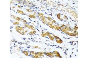 Immunohistochemistry of paraffin-embedded Human stomach using OGN Polyclonal Antibody at dilution of 1:100 (40x lens). (OGN anticorps)