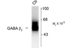 Image no. 2 for anti-gamma-aminobutyric Acid (GABA) A Receptor, beta 2 (GABRB2) (Cytoplasmic Domain) antibody (ABIN228403) (GABRB2 anticorps  (Cytoplasmic Domain))