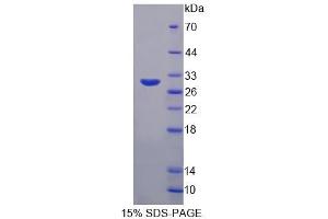 SDS-PAGE analysis of Human DPP3 Protein. (DPP3 Protéine)