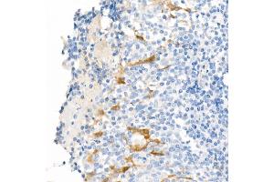 Immunohistochemistry of paraffin-embedded Human tonsil using  antibody (ABIN7265531) at dilution of 400 (40x lens).