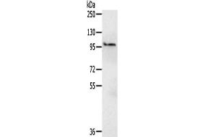 Gel: 6 % SDS-PAGE,Lysate: 40 μg,Primary antibody: ABIN7190553(EMC1 Antibody) at dilution 1/200 dilution,Secondary antibody: Goat anti rabbit IgG at 1/8000 dilution,Exposure time: 15 seconds (KIAA0090 anticorps)