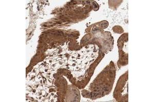 Immunohistochemical staining of human placenta with PITPNM2 polyclonal antibody  shows strong cytoplasmic and nuclear positivity in trophoblastic cells at 1:20-1:50 dilution. (PITPNM2 anticorps)