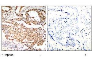 Image no. 1 for anti-Myocyte Enhancer Factor 2A (MEF2A) (pSer408) antibody (ABIN197080) (MEF2A anticorps  (pSer408))