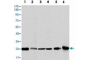 Western blot analysis using GSTM1 monoclonal antibody, clone 1H4F2  against MCF-7 (1) , PC-12 (2) , Jurkat (3) , HeLa (4) , HL7702 (5) and HepG2 (6) cell lysate. (GSTM1 anticorps)