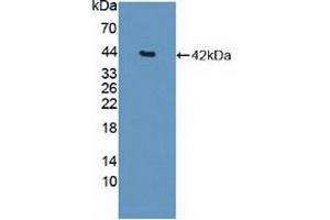 Figure. (HDAC9 anticorps  (AA 23-343))
