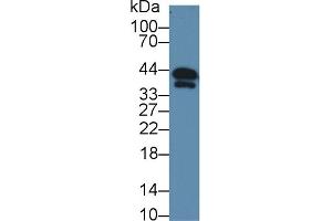 Detection of TNNT1 in Mouse Serum using Polyclonal Antibody to Troponin T Type 1, Slow Skeletal (TNNT1)