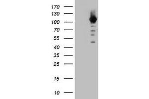 Image no. 1 for anti-Cullin 4B (CUL4B) (AA 1-300) antibody (ABIN1490725) (Cullin 4B anticorps  (AA 1-300))