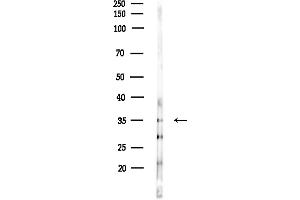 anti-Apolipoprotein L, 4 (APOL4) antibody