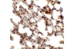 Immunohistochemistry of Coronin 7 in rat lung tissue with Coronin 7 antibody at 2. (Coronin 7 anticorps  (C-Term))