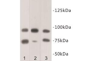 Western Blotting (WB) image for anti-SUZ12 Polycomb Repressive Complex 2 Subunit (SUZ12) antibody (ABIN1854978) (SUZ12 anticorps)
