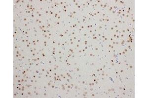 IHC-P: PDK2 antibody testing of rat brain tissue (PDK2 anticorps  (C-Term))