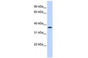 Image no. 1 for anti-Methylenetetrahydrofolate Dehydrogenase (NADP+ Dependent) 2, Methenyltetrahydrofolate Cyclohydrolase (MTHFD2) (AA 180-229) antibody (ABIN6740950) (MTHFD2 anticorps  (AA 180-229))