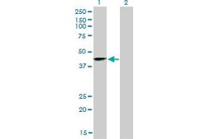 Western Blot analysis of SIRT2 expression in transfected 293T cell line by SIRT2 monoclonal antibody (M01), clone 4B11.