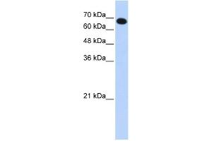 WB Suggested Anti-CCDC38 Antibody Titration: 0. (CCDC38 anticorps  (N-Term))