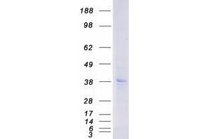 Validation with Western Blot