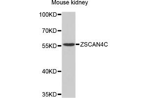 Western blot analysis of extracts of mouse kidney, using ZSCAN4 antibody (ABIN4905688) at 1:1000 dilution. (ZSCAN4C anticorps)