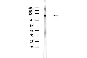 anti-Ribosomal Protein S6 Kinase, 90kDa, Polypeptide 3 (RPS6KA3) (pSer227) antibody