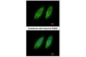 ICC/IF Image Immunofluorescence analysis of methanol-fixed HeLa, using GBF1, antibody at 1:200 dilution.