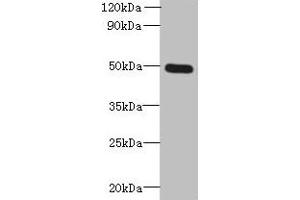 Western blot All lanes: TTYH1 antibody at 4 μg/mL + Raji whole cell lysate Secondary Goat polyclonal to rabbit IgG at 1/10000 dilution Predicted band size: 50, 27, 36 kDa Observed band size: 50 kDa (TTYH1 anticorps  (AA 50-178))