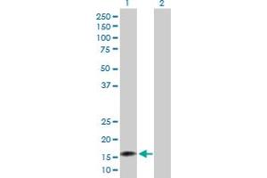 Western Blot analysis of NUDT2 expression in transfected 293T cell line by NUDT2 MaxPab polyclonal antibody. (NUDT2 anticorps  (AA 1-147))