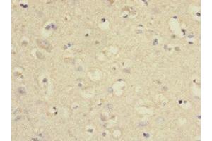 Immunohistochemistry of paraffin-embedded human brain tissue using ABIN7166579 at dilution of 1:100 (SLC2A13 anticorps  (AA 564-648))