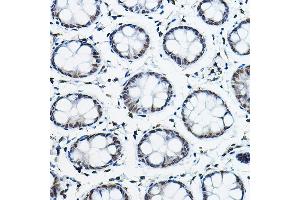 Immunohistochemistry of paraffin-embedded human colon using NCOR2 Rabbit pAb (ABIN6130575, ABIN6144422, ABIN6144423 and ABIN6224431) at dilution of 1:100 (40x lens).