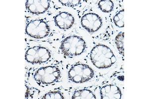 Immunohistochemistry of paraffin-embedded human colon using NCOR2 Rabbit pAb (ABIN6130575, ABIN6144422, ABIN6144423 and ABIN6224431) at dilution of 1:100 (40x lens). (NCOR2 anticorps  (AA 670-900))