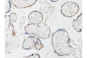 Image no. 4 for anti-Interleukin 15 (IL15) antibody (ABIN464931) (IL-15 anticorps)