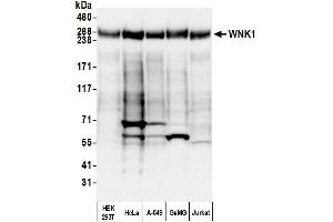 Western Blotting (WB) image for anti-WNK Lysine Deficient Protein Kinase 1 (WNK1) (AA 2100-2150) antibody (ABIN7450908) (WNK1 anticorps  (AA 2100-2150))