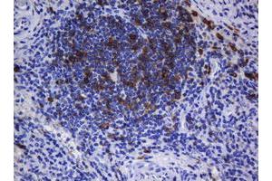 Immunohistochemistry (IHC) image for anti-T-cell surface glycoprotein CD1c (CD1C) antibody (ABIN2670676) (CD1c anticorps)