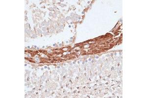 Immunohistochemistry of paraffin-embedded rat testis using KIFC1 antibody (ABIN1680592, ABIN3017666, ABIN3017667 and ABIN6220203) at dilution of 1:100 (40x lens).