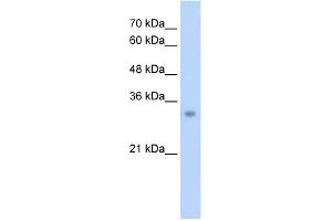 ECH1 antibody used at 2. (ECH1 anticorps  (N-Term))