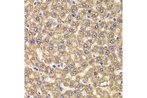 Immunohistochemistry of paraffin-embedded rat liver using UBE2J2 antibody (ABIN4905538) at dilution of 1:100 (40x lens). (UBE2J2 anticorps)