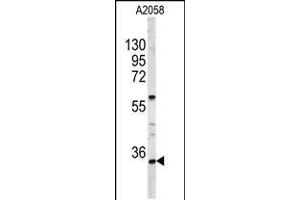 Western blot analysis of HOXA9 Antibody in A2058 cell line lysates (35ug/lane) (HOXA9 anticorps  (C-Term))