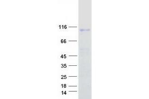 Validation with Western Blot
