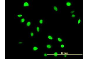Immunofluorescence of purified MaxPab antibody to FAF1 on HeLa cell.