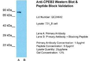 Host: Rabbit  Target Name: CPEB3  Sample Tissue: 721_B Whole Cell  Lane A:  Primary Antibody Lane B:  Primary Antibody + Blocking Peptide Primary Antibody Concentration: 1 µg/mL Peptide Concentration: 2 µg/mL Lysate Quantity: 241 µg/laneGel Concentration: 2. (CPEB3 anticorps  (Middle Region))