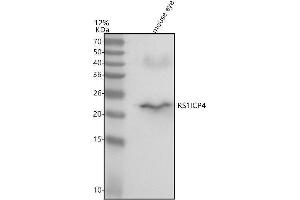 Western blot analysis of RS1 using anti-RS1 antibody (ABIN7601377).